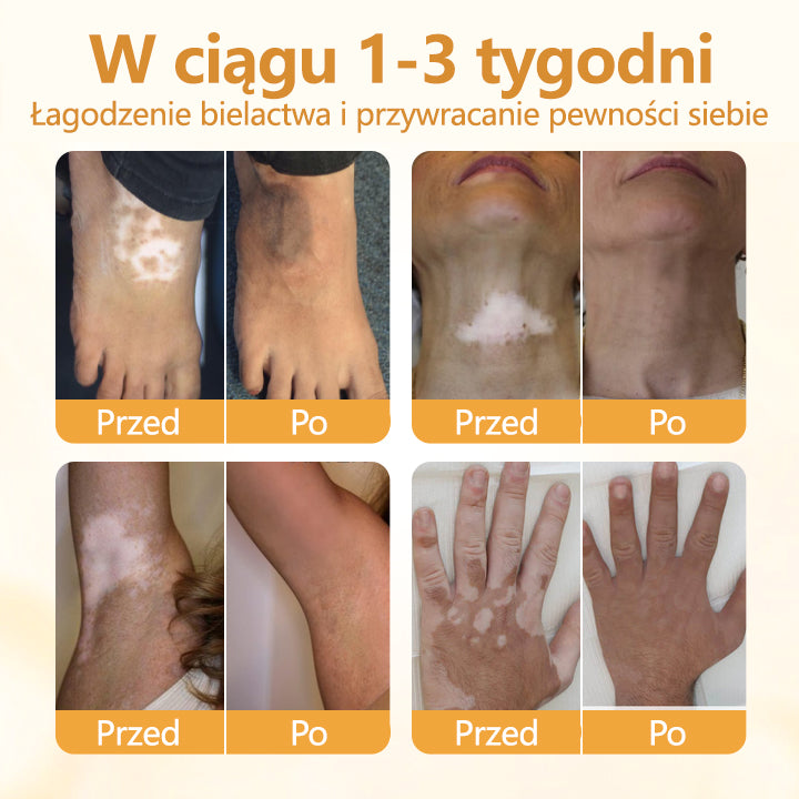 Timilk® VitiCalm krem z jadem pszczelim🌻