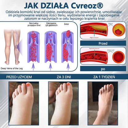 💧💧ATTDX® Krem ziołowy łagodzący obrzęki z czarnuszką