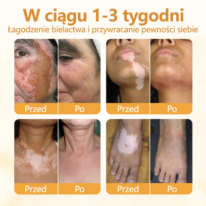 Timilk® VitiCalm krem z jadem pszczelim🌻
