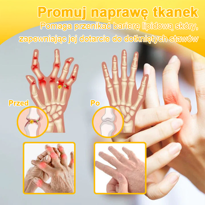 TLOPA® Toksyna botulinowa i jad pszczeli Balsam Łagodzący Ból i Leczenie Kości🐝🌿 (Polecane dla seniorów przez ortopedów)🎁