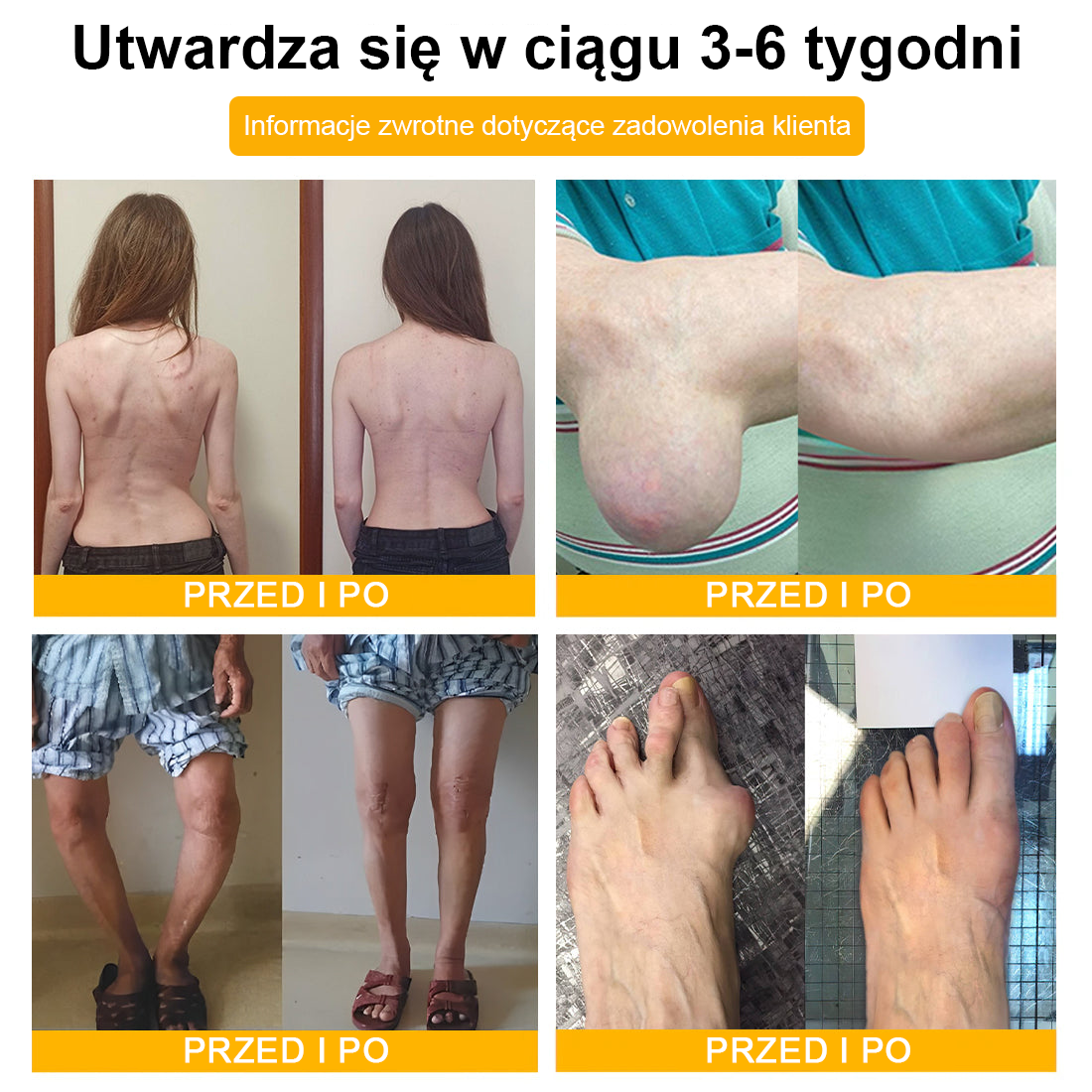 TLOPA® Toksyna botulinowa i jad pszczeli Balsam Łagodzący Ból i Leczenie Kości🐝🌿 (Polecane dla seniorów przez ortopedów)🎁