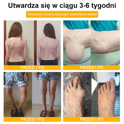 TLOPA® Toksyna botulinowa i jad pszczeli Balsam Łagodzący Ból i Leczenie Kości🐝🌿 (Polecane dla seniorów przez ortopedów)🎁