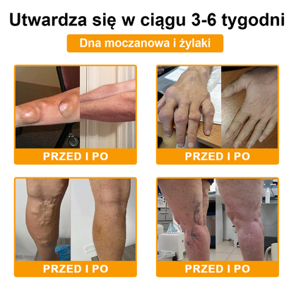 TLOPA® Toksyna botulinowa i jad pszczeli Balsam Łagodzący Ból i Leczenie Kości🐝🌿 (Polecane dla seniorów przez ortopedów)🎁