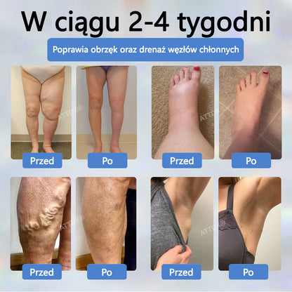 💧💧ATTDX® Krem ziołowy łagodzący obrzęki z czarnuszką