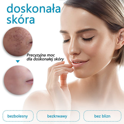 Mresio® Profesjonalny Laser CO2 do użytku domowego – Shot Erase Pro