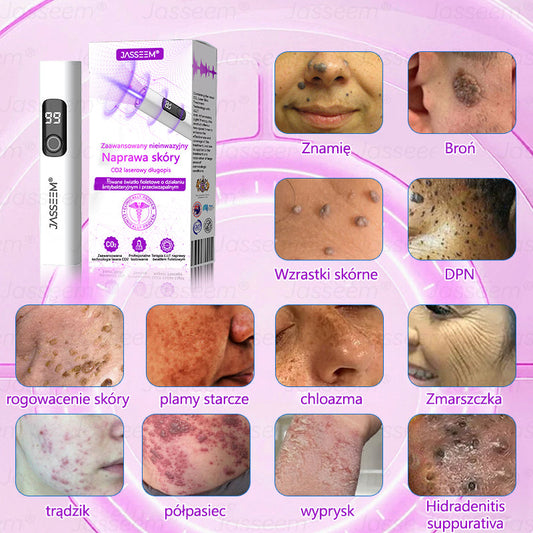 𝐉𝐚𝐬𝐬𝐞𝐞𝐦® Zaawansowany nieinwazyjny laser CO₂ do naprawy skóry 🎉 (Delikatnie usuwa brodawki, znamiona, plamy starcze i narośla skórne – bez bólu, bez zamieszania!)