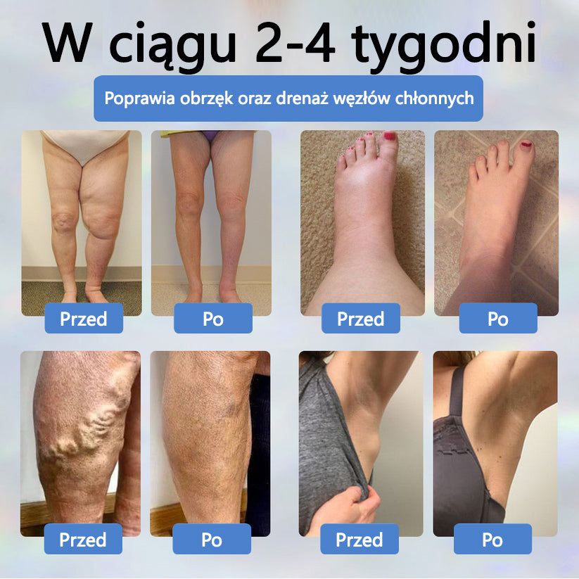 Detoksykujący krem ziołowy z czarnym kminkiem Cvreoz®⭐️