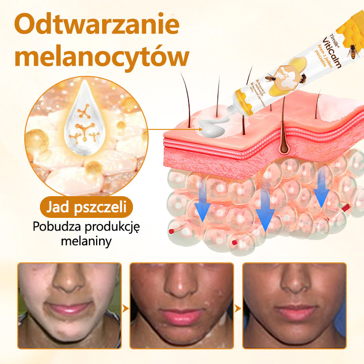 Timilk® VitiCalm krem z jadem pszczelim🌻