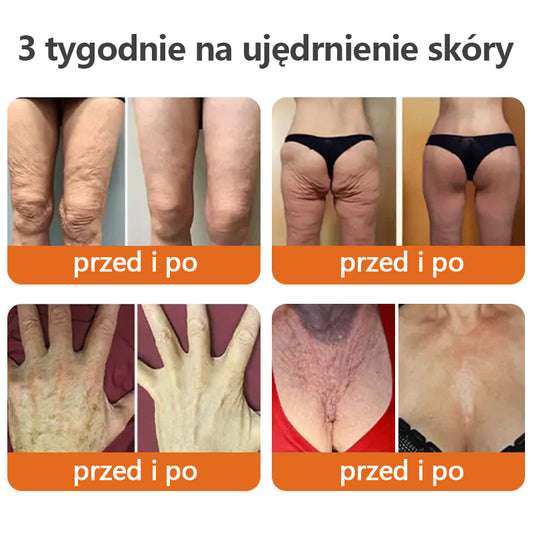 ✨𝗧𝗟𝗢𝗣𝗔® AH-8 Krem ujędrniający do szyi, poprawiający elastyczność skóry, krem do szyi z rolką, nawilżający i ujędrniający balsam, kosmetyki do pielęgnacji skóry, regeneracja skóry (🔥Ostatni dzień 70% zniżki)