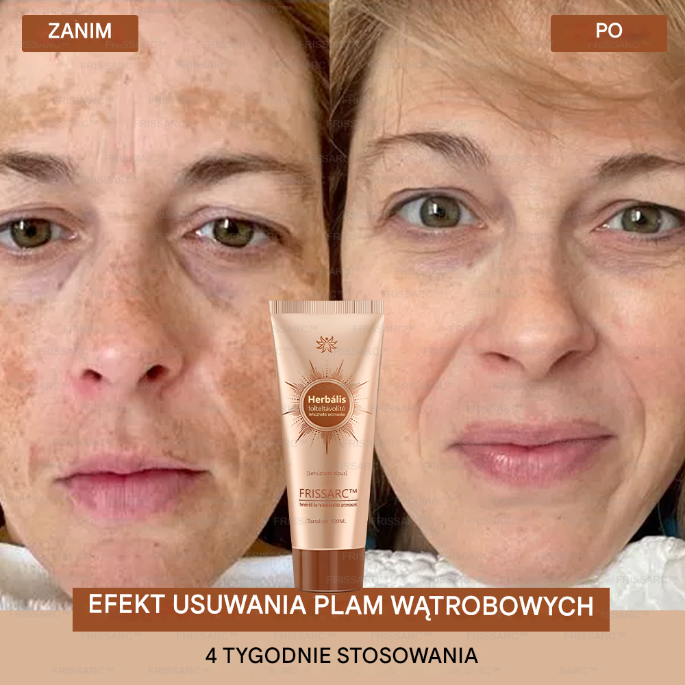 💟 FRISSARC™ wybielająca i usuwająca plamy maseczka do twarzy