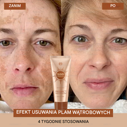 💟 FRISSARC™ wybielająca i usuwająca plamy maseczka do twarzy