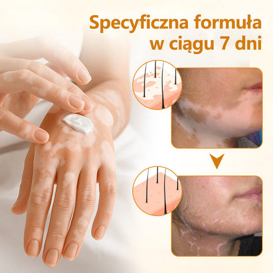 Timilk® VitiCalm krem z jadem pszczelim🌻