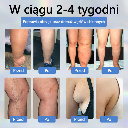 Detoksykujący krem ziołowy z czarnym kminkiem Cvreoz®⭐️