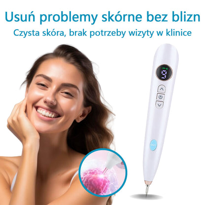 Mresio® Profesjonalny Laser CO2 do użytku domowego – Shot Erase Pro