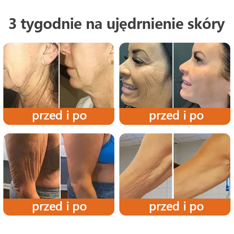 ✨𝗧𝗟𝗢𝗣𝗔® AH-8 Krem ujędrniający do szyi, poprawiający elastyczność skóry, krem do szyi z rolką, nawilżający i ujędrniający balsam, kosmetyki do pielęgnacji skóry, regeneracja skóry (🔥Ostatni dzień 70% zniżki)