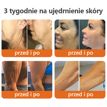 ✨𝗧𝗟𝗢𝗣𝗔® AH-8 Krem ujędrniający do szyi, poprawiający elastyczność skóry, krem do szyi z rolką, nawilżający i ujędrniający balsam, kosmetyki do pielęgnacji skóry, regeneracja skóry (🔥Ostatni dzień 70% zniżki)