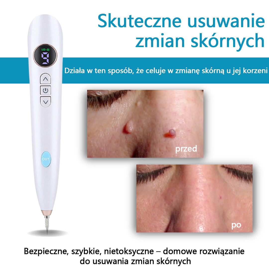 Mresio® Profesjonalny Laser CO2 do użytku domowego – Shot Erase Pro