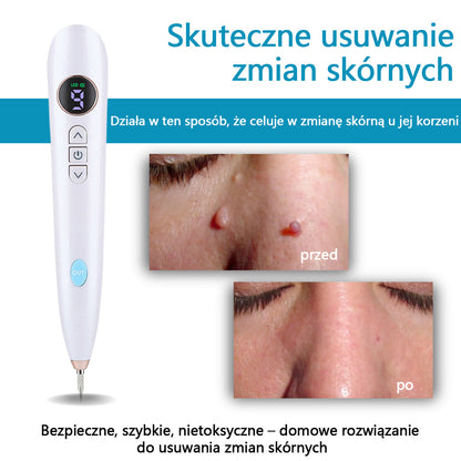 Mresio® Profesjonalny Laser CO2 do użytku domowego – Shot Erase Pro