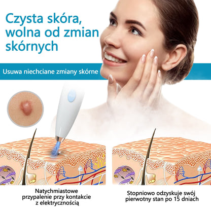 Mresio® Profesjonalny Laser CO2 do użytku domowego – Shot Erase Pro