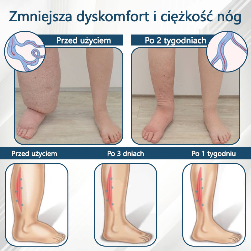 Detoksykujący krem ziołowy z czarnym kminkiem Cvreoz®⭐️