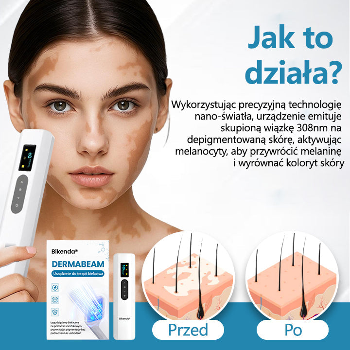 Bikenda® DermaBeam Urządzenie Terapeutyczne do Leczenia Bielactwa