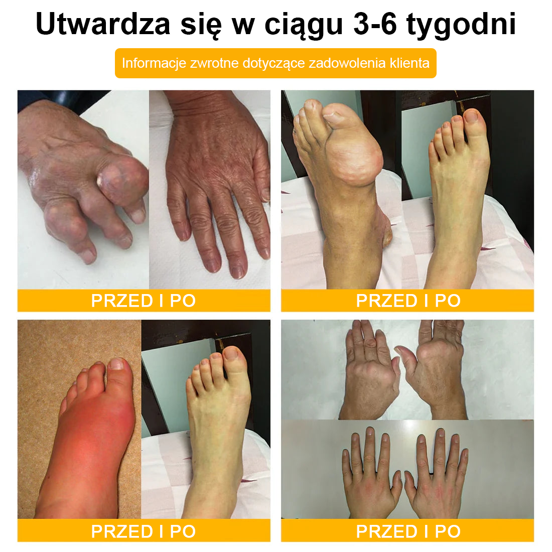 TLOPA® Toksyna botulinowa i jad pszczeli Balsam Łagodzący Ból i Leczenie Kości🐝🌿 (Polecane dla seniorów przez ortopedów)🎁