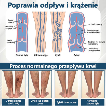 Detoksykujący krem ziołowy z czarnym kminkiem Cvreoz®⭐️
