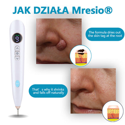 Mresio® Profesjonalny Laser CO2 do użytku domowego – Shot Erase Pro
