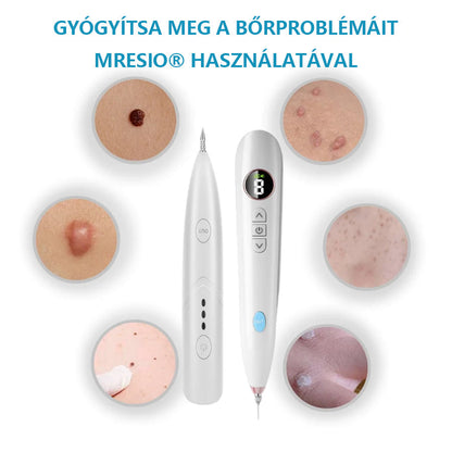 Mresio® Profesjonalny Laser CO2 do użytku domowego – Shot Erase Pro