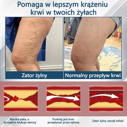 💧💧ATTDX® Krem ziołowy łagodzący obrzęki z czarnuszką