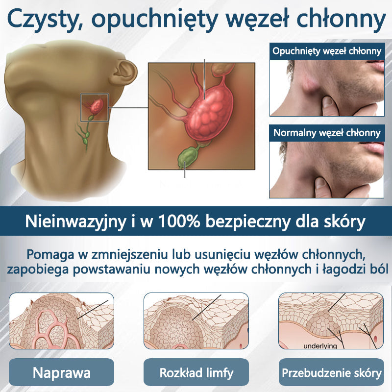 💧💧ATTDX® Krem ziołowy łagodzący obrzęki z czarnuszką