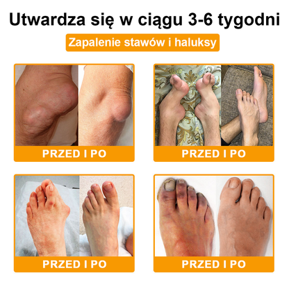 TLOPA® Toksyna botulinowa i jad pszczeli Balsam Łagodzący Ból i Leczenie Kości🐝🌿 (Polecane dla seniorów przez ortopedów)🎁