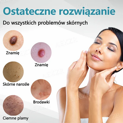 Bikenda® ❤️Laser Pen do nieinwazyjnego usuwania znamion i brodawek